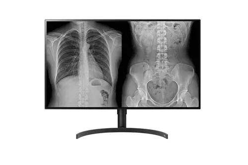Monitor LG Médico 31.5" IPS 5ms 5Y